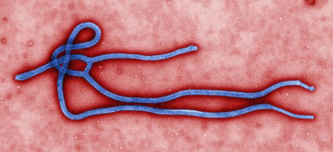 Ebola virus virion. Created by CDC microbiologist Cynthia Goldsmith, this colorized transmission electron micrograph (TEM) revealed some of the ultrastructural morphology displayed by an Ebola virus virion. Public Health Image Library, #10816. The image is in the public domain. Via Wikimedia Commons.
